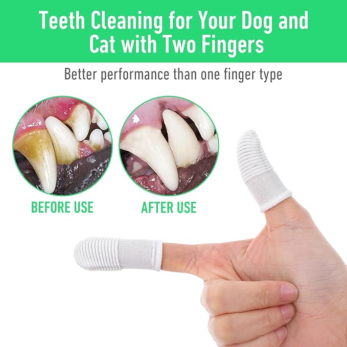 YUIANLB 40 Pcs Pet Dental Care Kit Finger Toothbrush Oral Cleaning Wipes Soft Washable Fabric Freshens Breath Reduces Plaque Tartar Complete Oral Hygiene Set for Puppies Kittens at Home